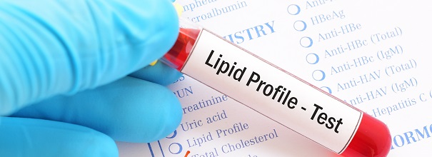 Lipids Resources and Management