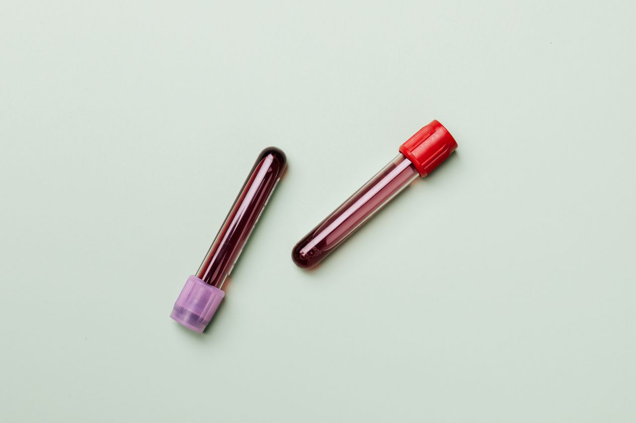 Two blood collection tubes representing Galleri multi-cancer early detection testing in Fort Myers