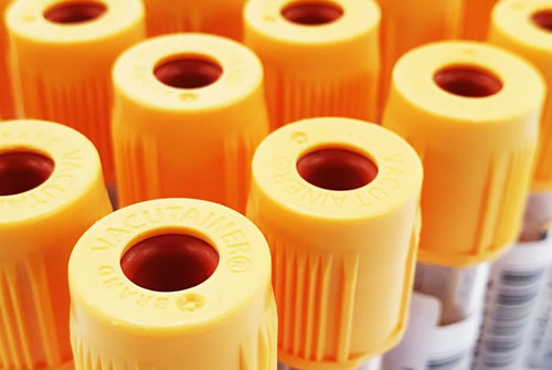 Close-up of blood collection tubes with yellow caps for CancerGuard multi-cancer blood testing
